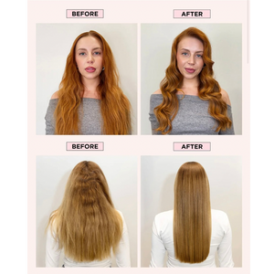 HOLD.ME Cloud 9 Hold & Control Kit