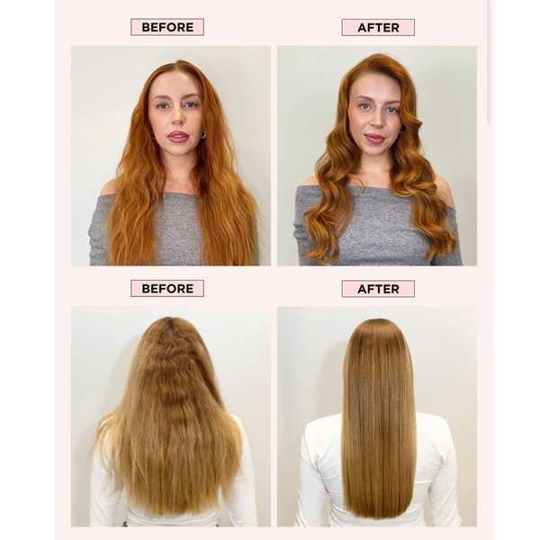 HOLD.ME Cloud 9 Hold & Control Kit