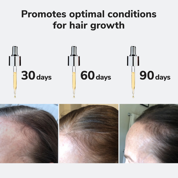 Youth Juice Scalp Treatment